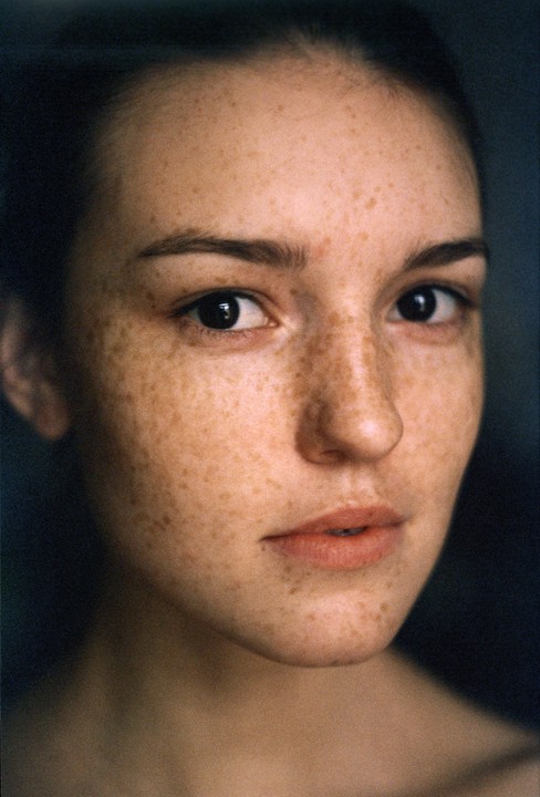 A woman with freckles looks directly at the viewer.