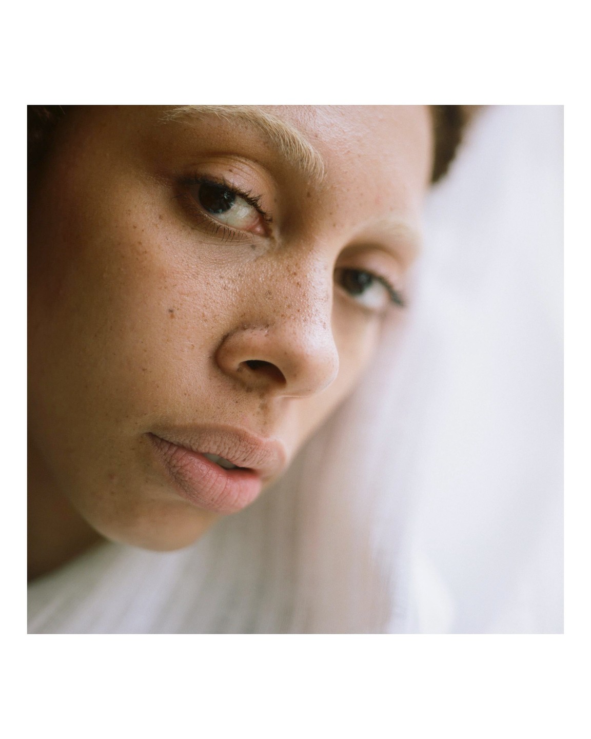 A woman with freckles and light eyebrows looks directly at the viewer.