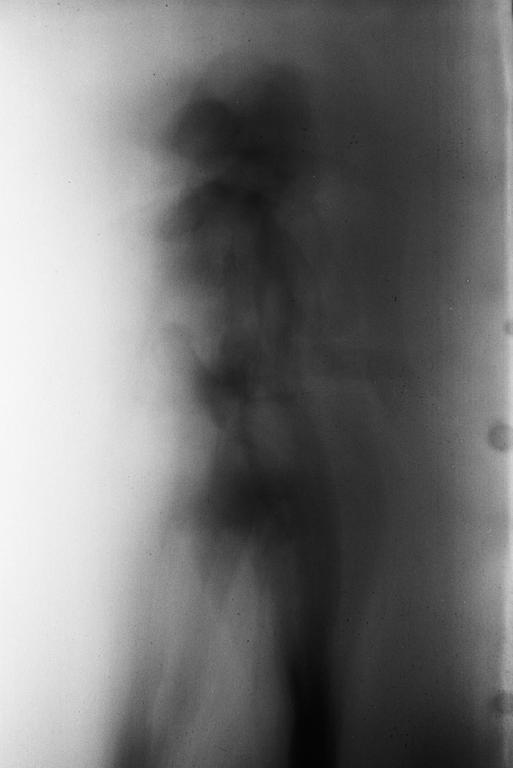 A blurry, abstract image shows a dark, vertical shape against a lighter background.