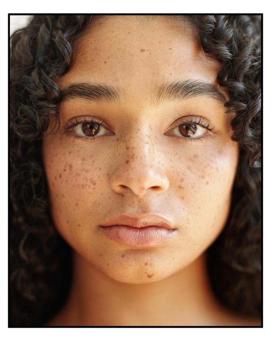 A woman with curly hair and freckles looks directly at the viewer.