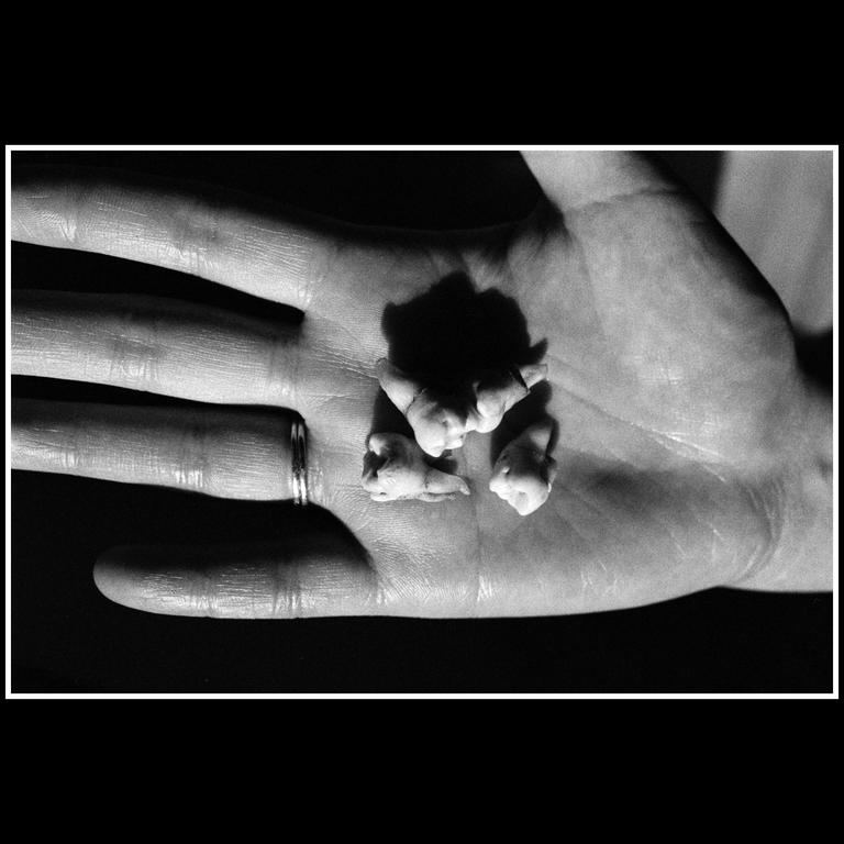 A hand with a ring on the ring finger holds three small teeth.
