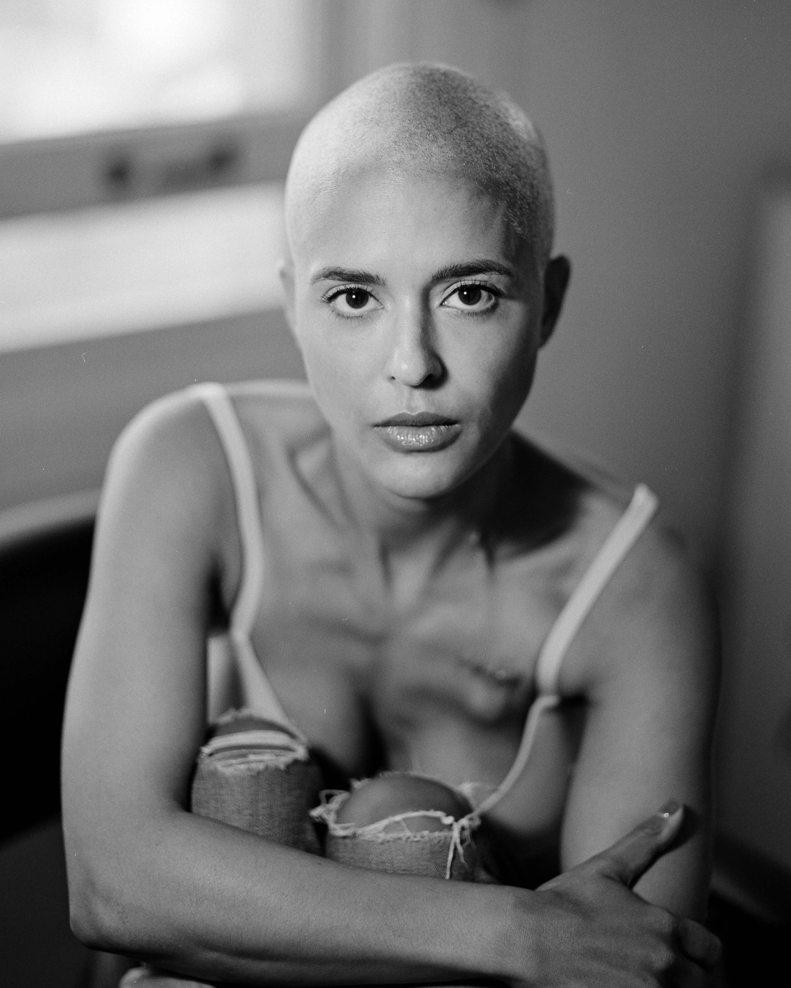A woman with a shaved head and a scar on her chest looks directly at the viewer.