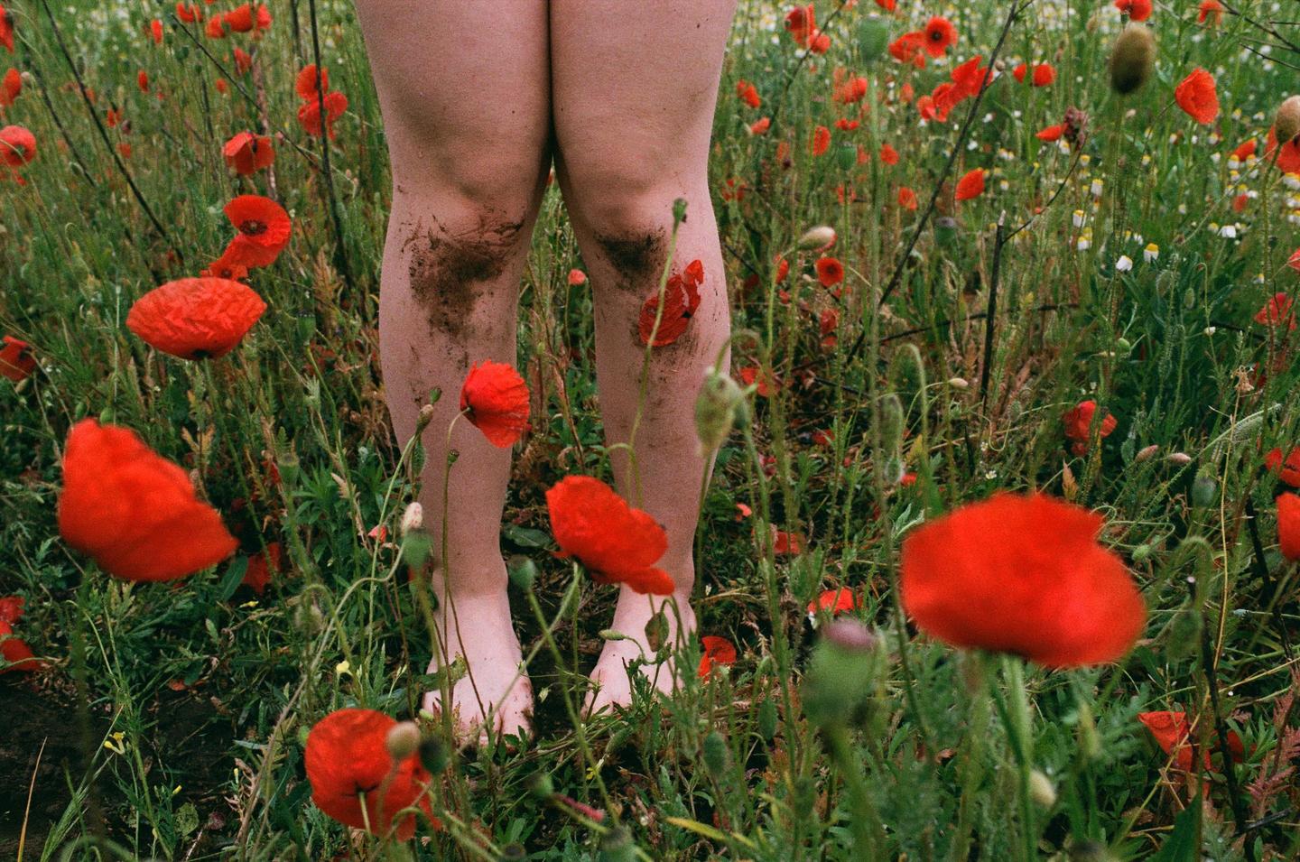 A person's legs and feet are visible in a field of red poppies and green grass.