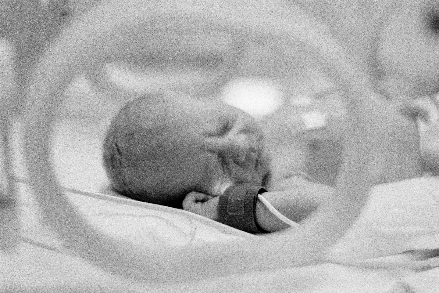 A baby with a medical device on its wrist is sleeping in a hospital bed.