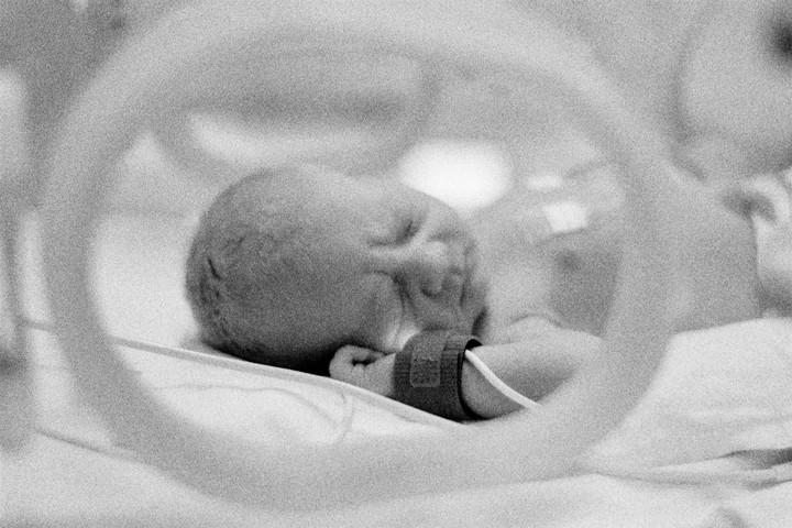 A baby with a medical device on its wrist is sleeping in a hospital bed.