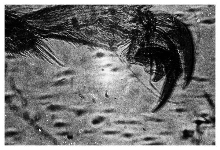A magnified view shows the leg of a small creature with visible claws and hair-like structures.
