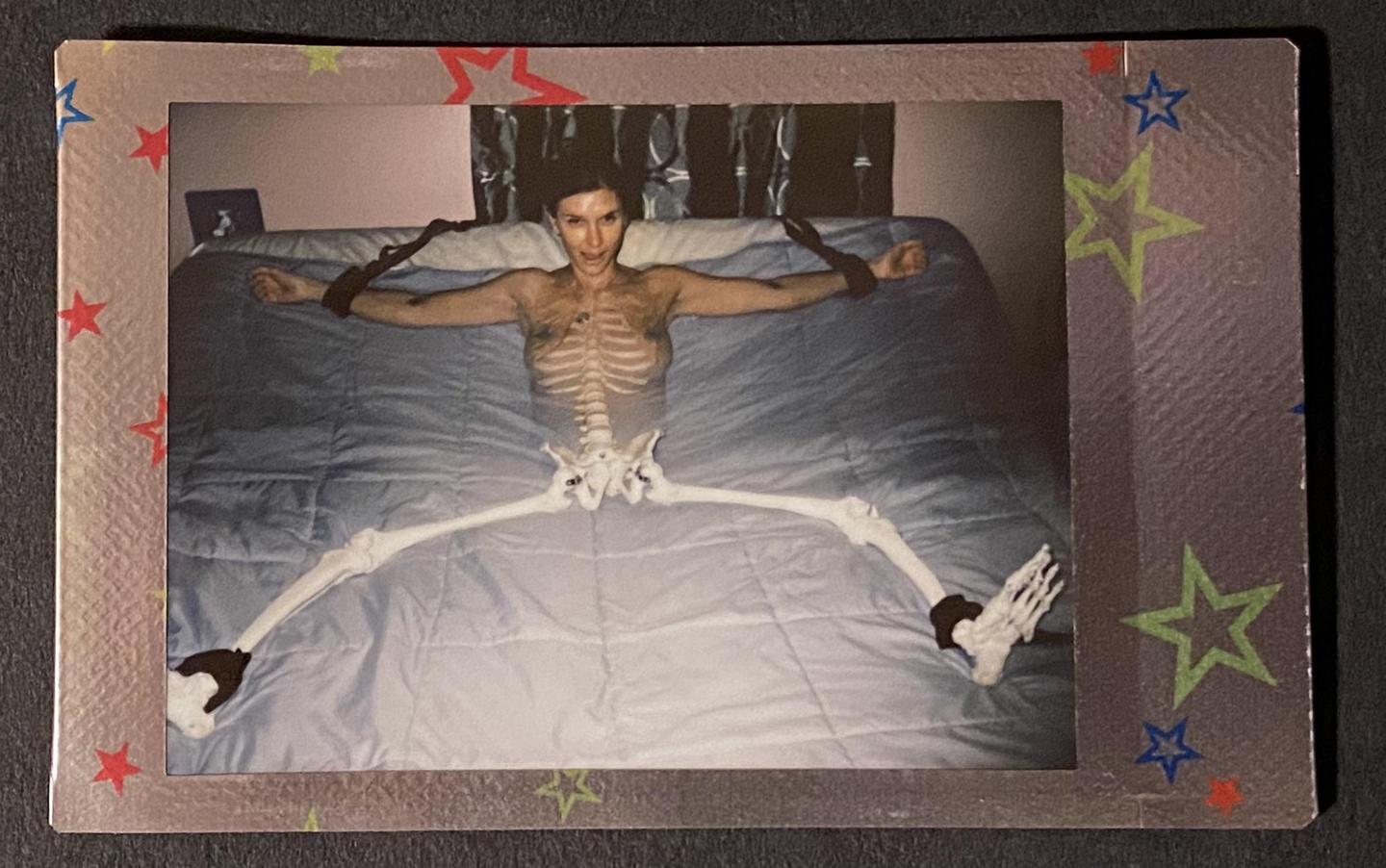 A woman with a skeleton torso is lying on a bed with her arms and legs restrained.