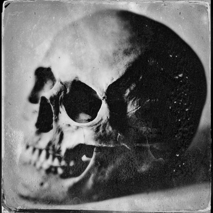A skull is shown in profile with a dark shadow covering half of its cranium.