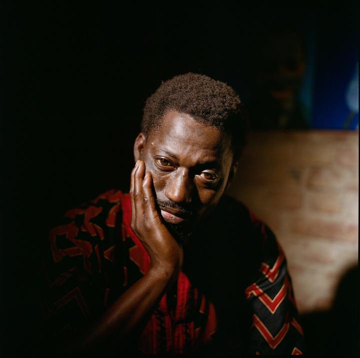 A man with a beard and short hair rests his chin on his hand while looking at the viewer.