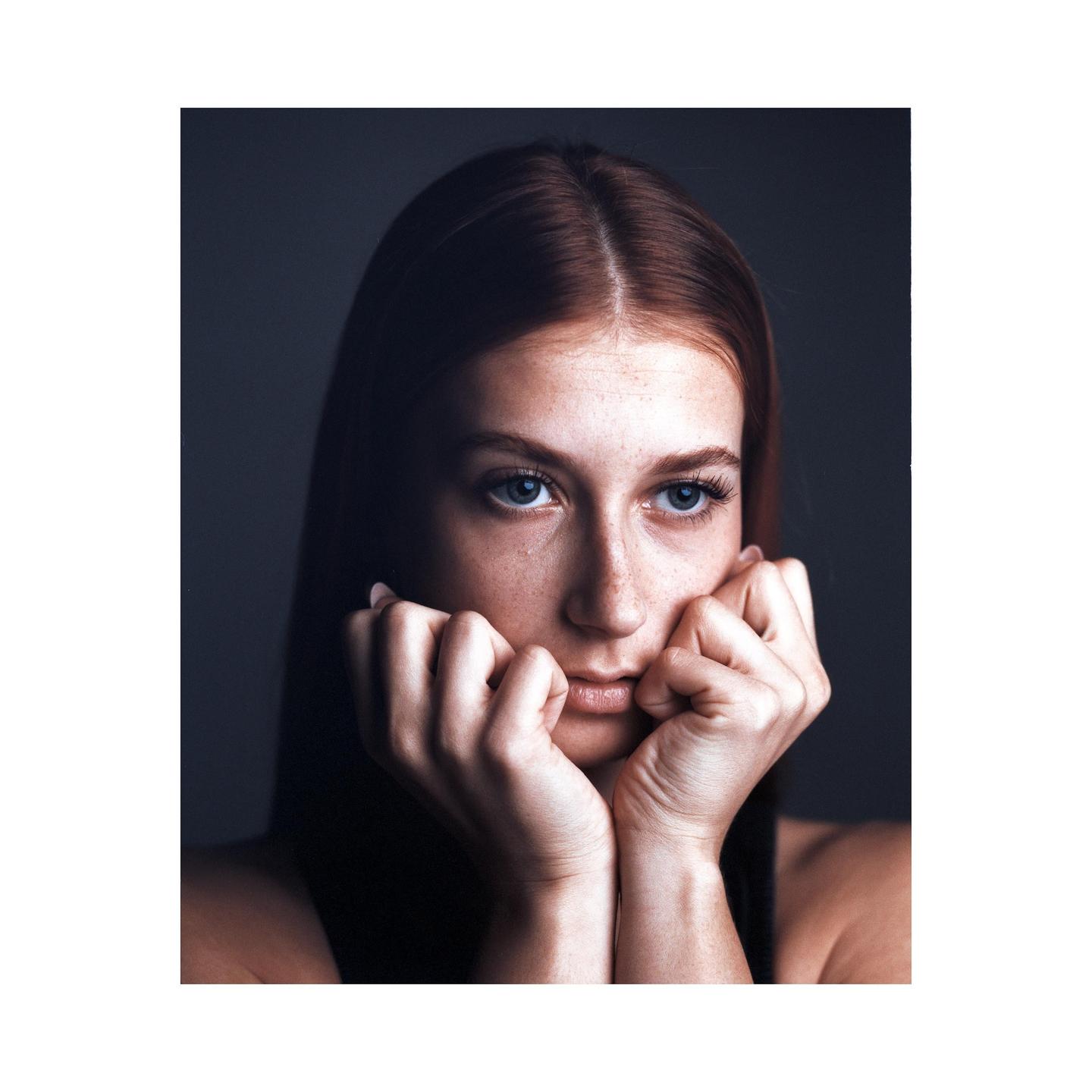 A woman with long red hair and freckles rests her chin on her hands and looks to the side.