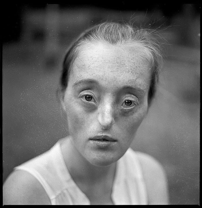 A woman with freckles and dark circles under her eyes looks directly at the viewer.