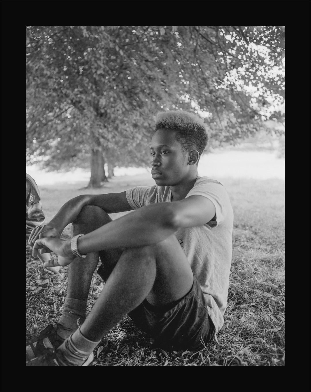 A young man sits on the grass under a tree, looking to the side.