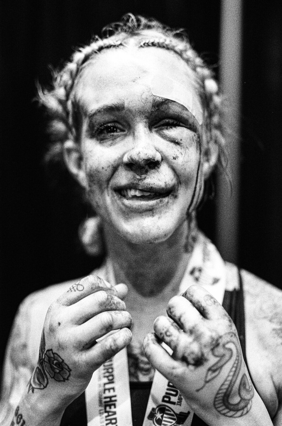 A woman with a bandaged forehead and dirty face smiles at the camera, showing tattoos on her hands and a medal around her neck.