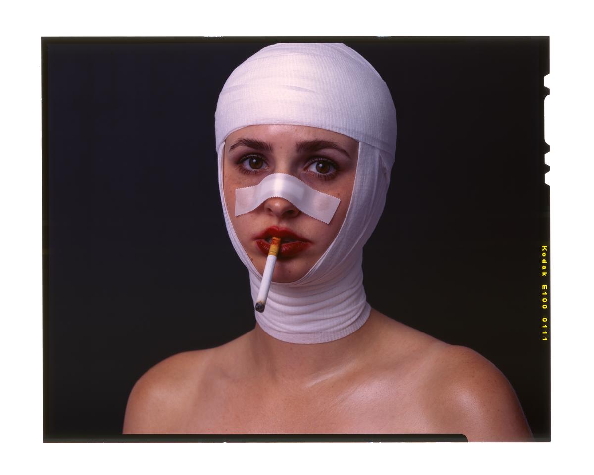 A woman with bandages on her head and nose holds a lit cigarette in her mouth.