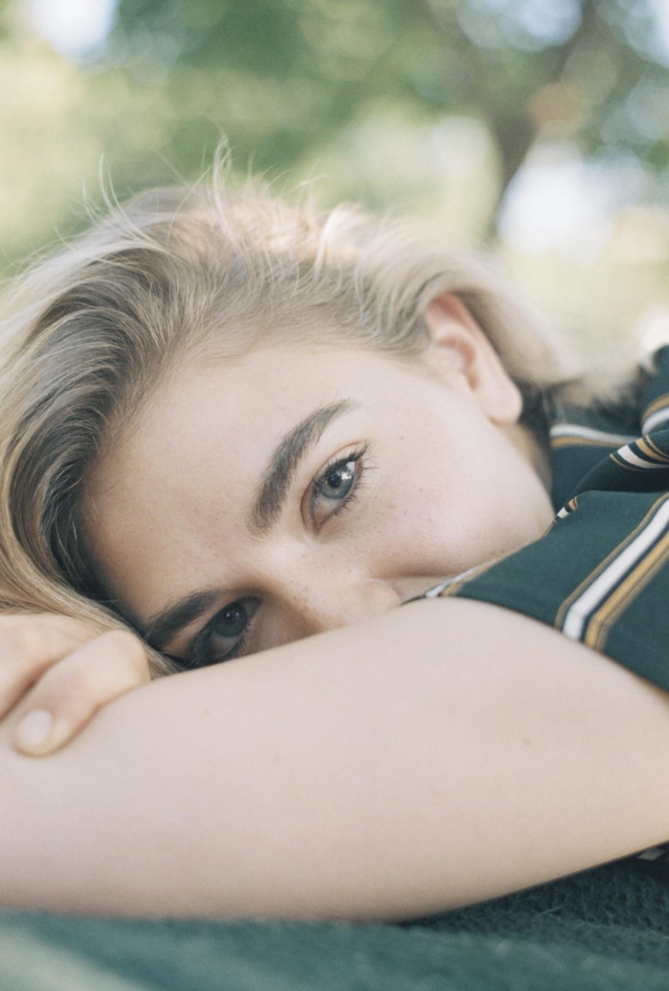 A woman with blonde hair and freckles looks at the viewer while resting her head on her arm.
