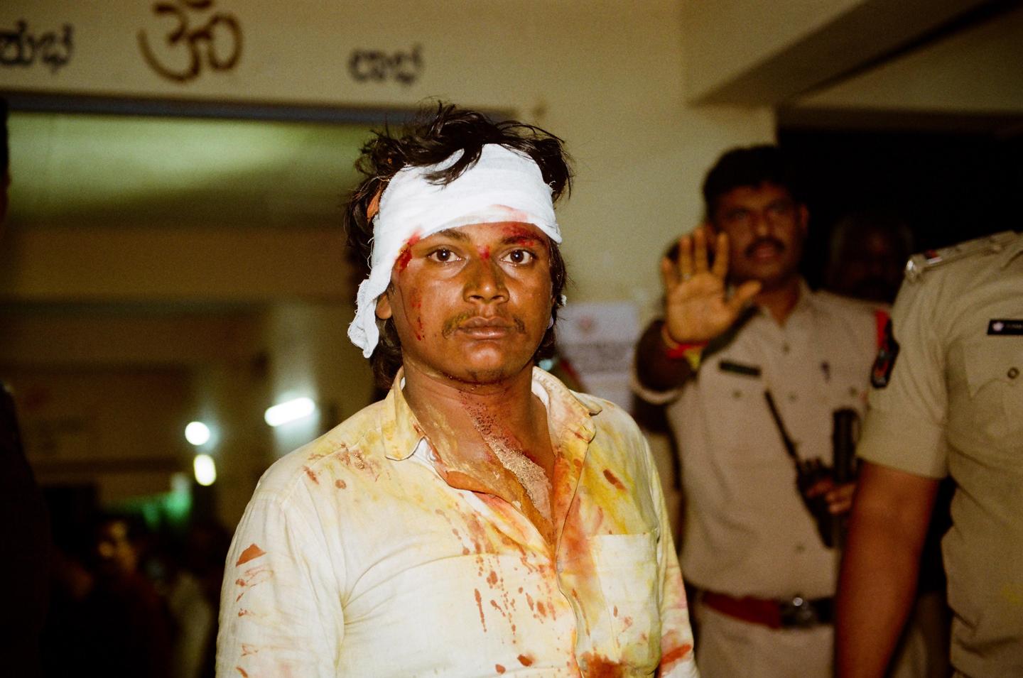 A man with a bandaged head and blood on his face and shirt stands in front of a blurred background with other men.