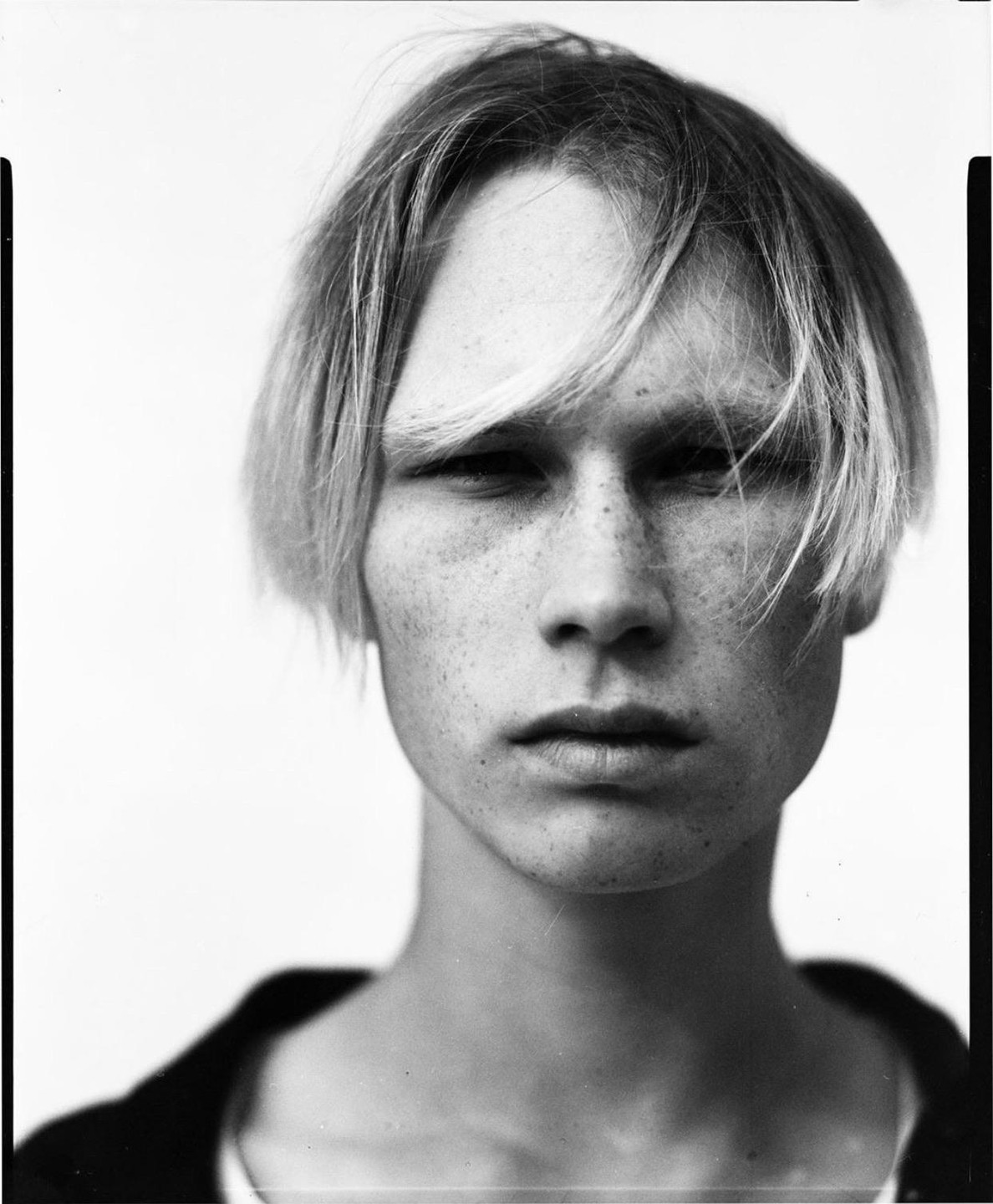 A young man with freckles and light hair looks directly at the viewer.