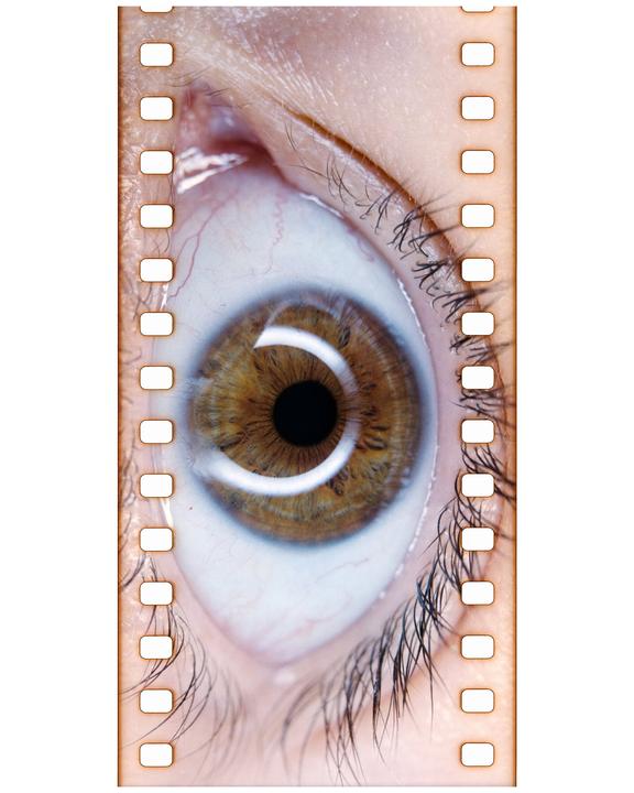 A close-up of an eye with a brown iris and visible blood vessels is framed by a film strip.