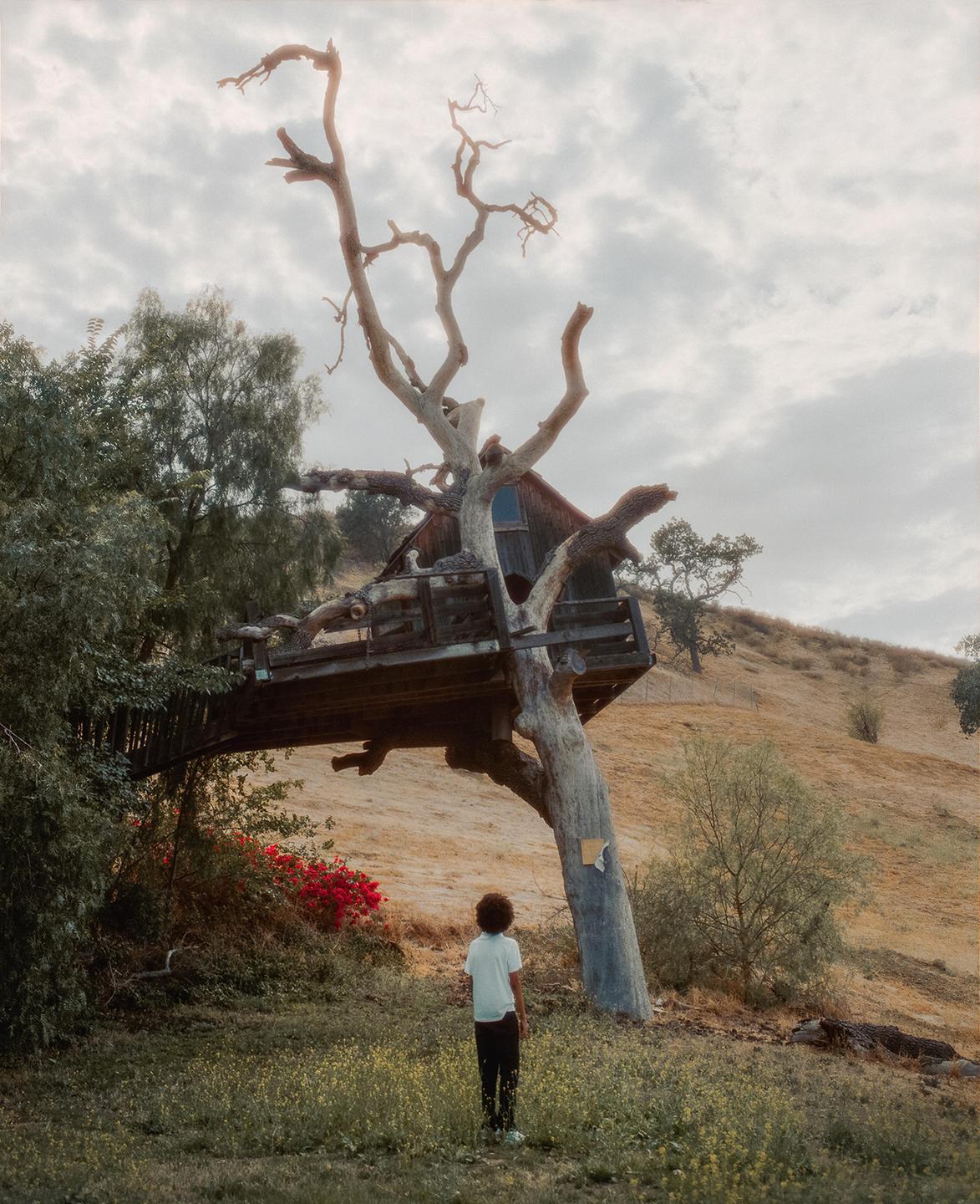 A child stands in a field looking up at a treehouse built into a large, gnarled tree on a hillside.