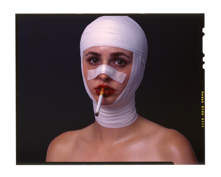 A woman with bandages on her head and nose holds a lit cigarette in her mouth.
