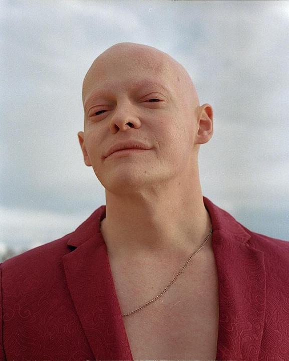 A man with a bald head and a red patterned jacket looks directly at the viewer.