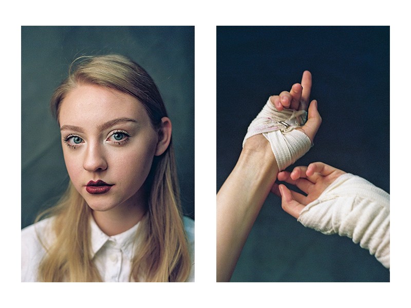 A diptych shows a woman with dark lipstick and a white shirt on the left, and a pair of bandaged hands on the right.