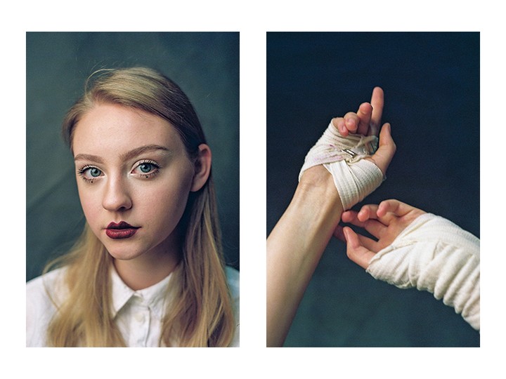 A diptych shows a woman with dark lipstick and a white shirt on the left, and a pair of bandaged hands on the right.